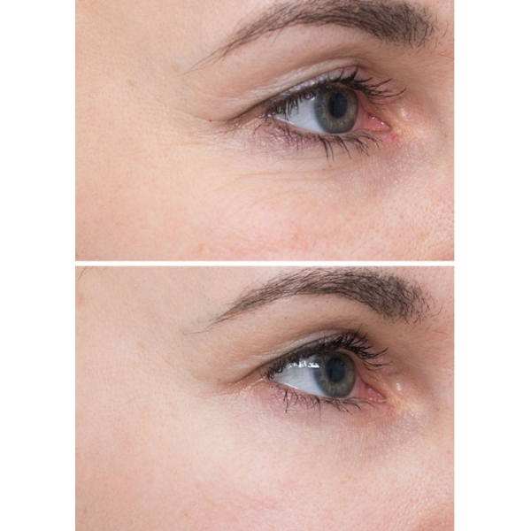 Multikyselinové exfoliační polštářky Instytutum Flawless Pads