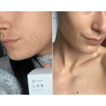 Peau-Parfaite Proti Nedokonalostem Pleti D-LAB